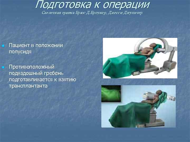 Подготовка к операции Скелетная травма Брюс Д. Броунер, Джесси Джупитер n n Пациент в