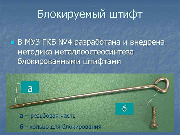 Блокируемый штифт n В МУЗ ГКБ № 4 разработана и внедрена методика металлоостеосинтеза блокированными