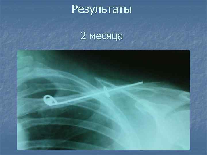 Результаты 2 месяца 