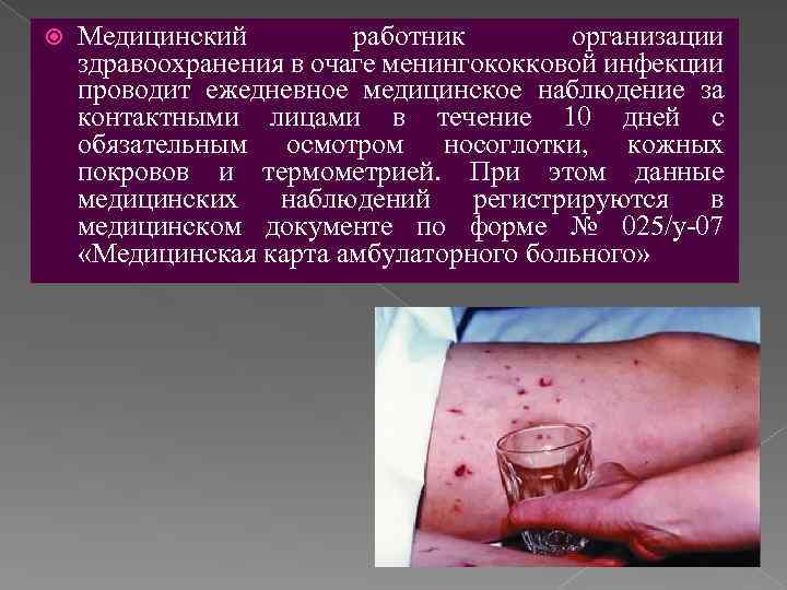  Медицинский работник организации здравоохранения в очаге менингококковой инфекции проводит ежедневное медицинское наблюдение за
