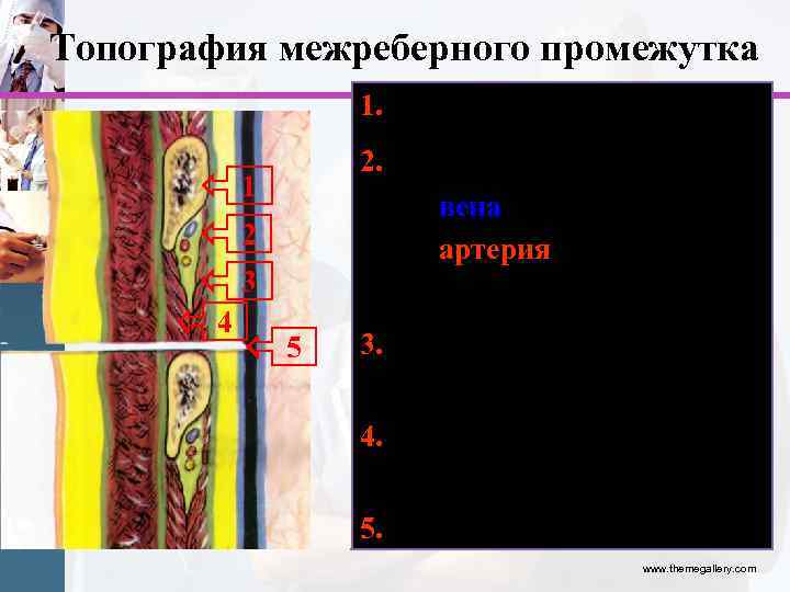 Топография межреберного промежутка 1. Ребро 2. Сосудисто-нервный пучок вена артерия нерв 1 2 3