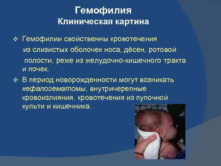 Гемофилия Клиническая картина Гемофилии свойственны кровотечения из слизистых оболочек носа, дёсен, ротовой полости, реже