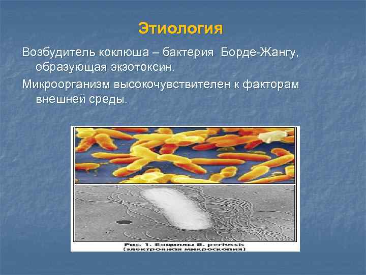 Этиология Возбудитель коклюша – бактерия Борде-Жангу, образующая экзотоксин. Микроорганизм высокочувствителен к факторам внешней среды.