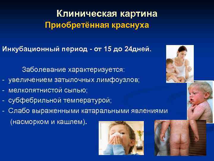 Клиническая картина Приобретённая краснуха Инкубационный период - от 15 до 24 дней. - Заболевание