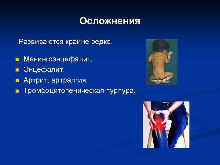 Осложнения Развиваются крайне редко. n n Менингоэнцефалит. Энцефалит. Артрит, артралгия. Тромбоцитопеническая пурпура. 