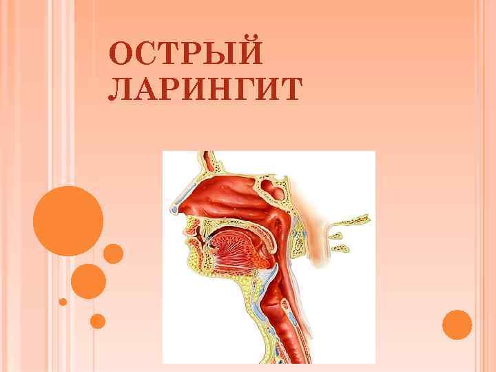 Ларингит лечение. Флегмонозный ларингит. Диффузный острый ларингит. Грануляционный ларингит.