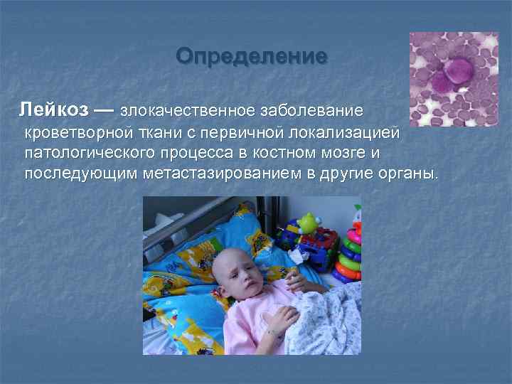 Определение Лейкоз — злокачественное заболевание кроветворной ткани с первичной локализацией патологического процесса в костном