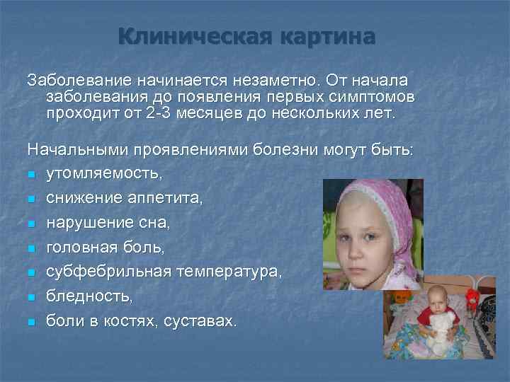 Клиническая картина Заболевание начинается незаметно. От начала заболевания до появления первых симптомов проходит от