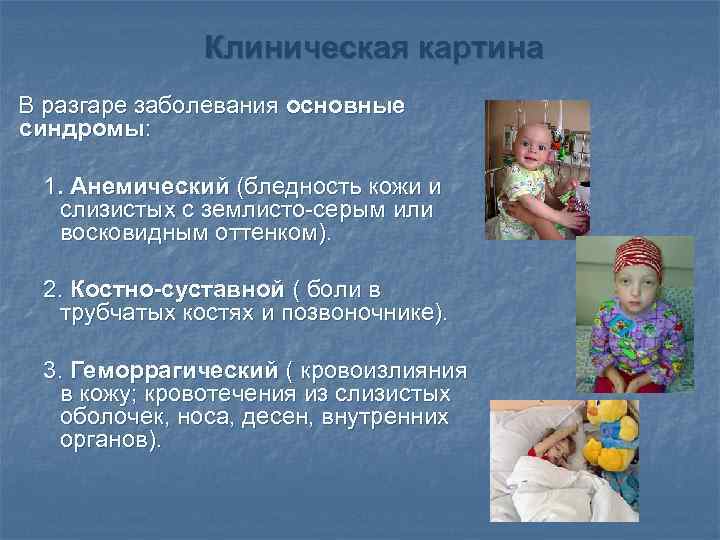 Клиническая картина В разгаре заболевания основные синдромы: 1. Анемический (бледность кожи и слизистых с
