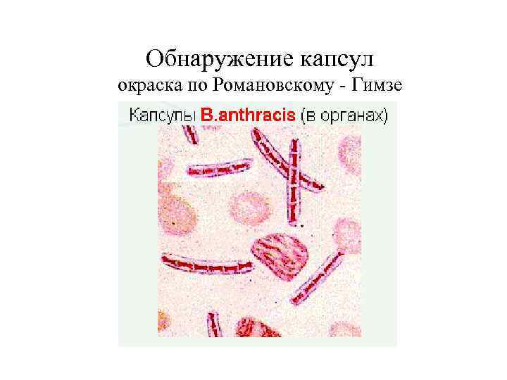 Обнаружение капсул окраска по Романовскому - Гимзе 