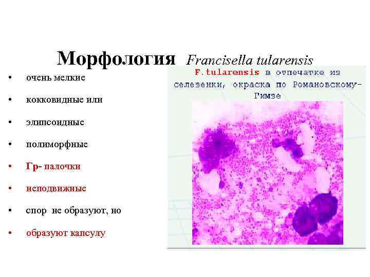 Морфология Francisella tularensis • очень мелкие • кокковидные или • элипсоидные • полиморфные •