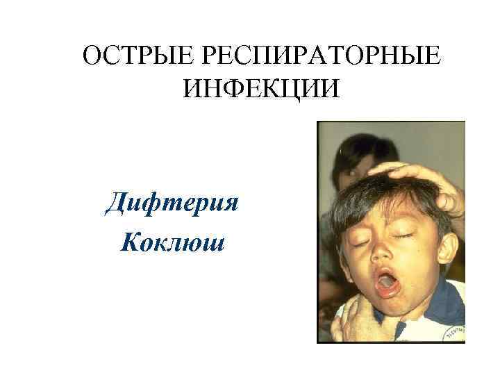 ОСТРЫЕ РЕСПИРАТОРНЫЕ ИНФЕКЦИИ Дифтерия Коклюш 