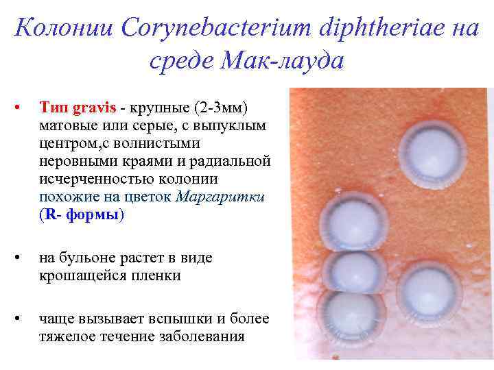 Колонии Corynebacterium diphtheriae на среде Мак-лауда • Тип gravis - крупные (2 -3 мм)