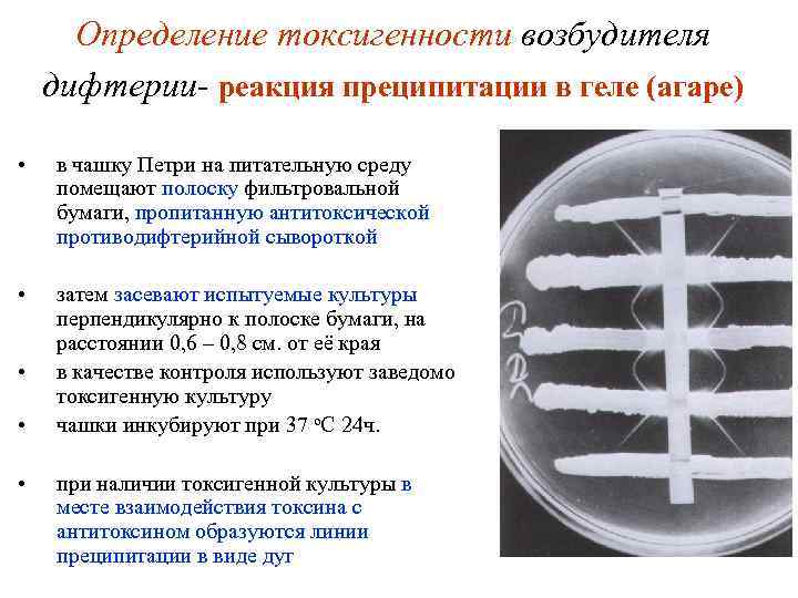 Определение токсигенности возбудителя дифтерии- реакция преципитации в геле (агаре) • в чашку Петри на