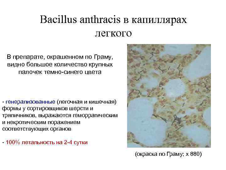 Bacillus anthracis в капиллярах легкого В препарате, окрашенном по Граму, видно большое количество крупных