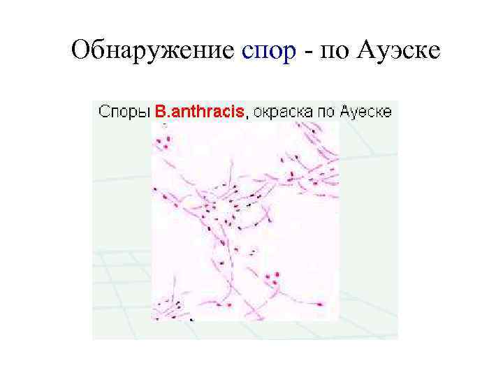 Обнаружение спор - по Ауэске 