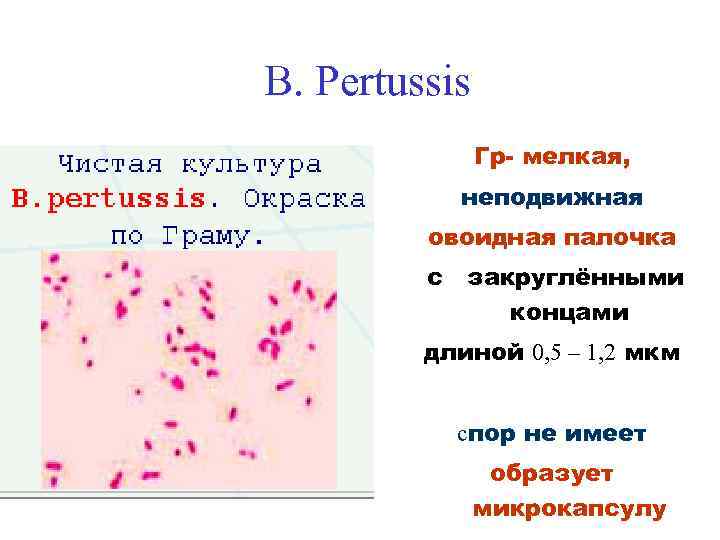 В. Pertussis Гр- мелкая, неподвижная овоидная палочка с закруглёнными концами длиной 0, 5 –