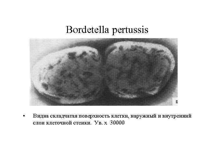 Bordetella pertussis • Видна складчатая поверхность клетки, наружный и внутренний слои клеточной стенки. Ув.