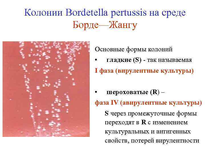 Колонии Bordetella pertussis на среде Борде—Жангу Основные формы колоний • гладкие (S) - так