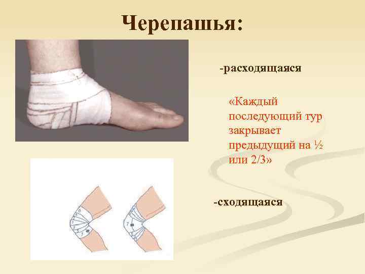 Черепашья: -расходящаяся n - возвращающаяся; «Каждый последующий тур закрывает предыдущий на ½ или 2/3»