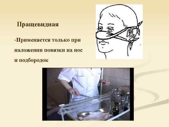 Пращевидная -Применяется только при наложении повязки на нос и подбородок 