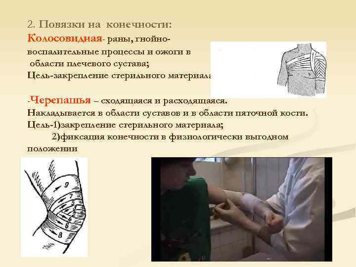 2. Повязки на конечности: Колосовидная- раны, гнойновоспалительные процессы и ожоги в области плечевого сустава;