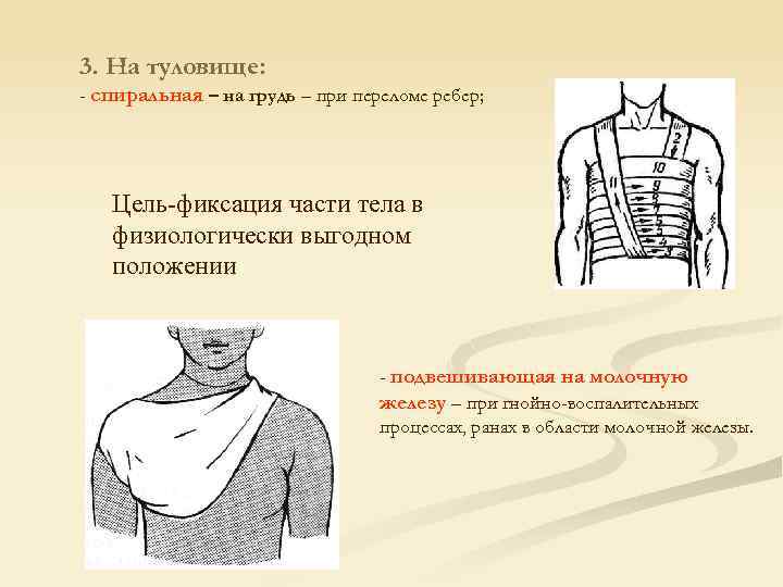 Закрытый перелом ребра карта вызова