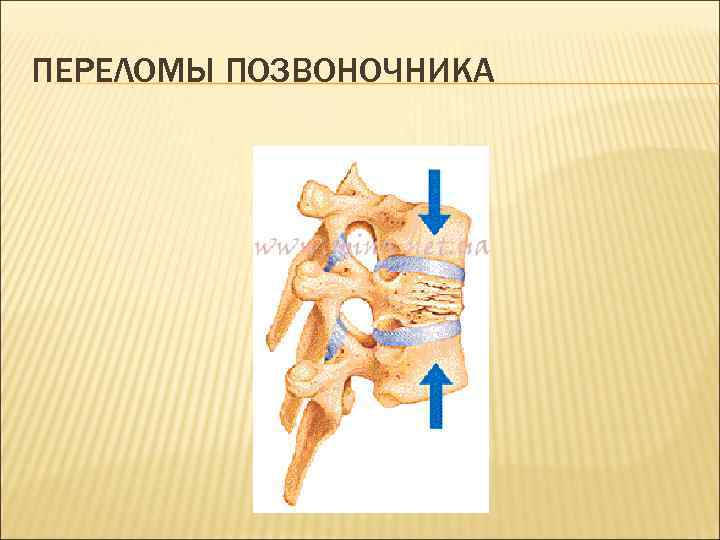 ПЕРЕЛОМЫ ПОЗВОНОЧНИКА 