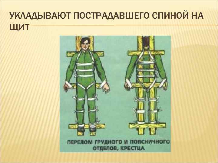 УКЛАДЫВАЮТ ПОСТРАДАВШЕГО СПИНОЙ НА ЩИТ 