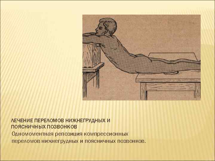 ЛЕЧЕНИЕ ПЕРЕЛОМОВ НИЖНЕГРУДНЫХ И ПОЯСНИЧНЫХ ПОЗВОНКОВ Одномоментная репозиция компрессионных переломов нижнегрудных и поясничных позвонков.