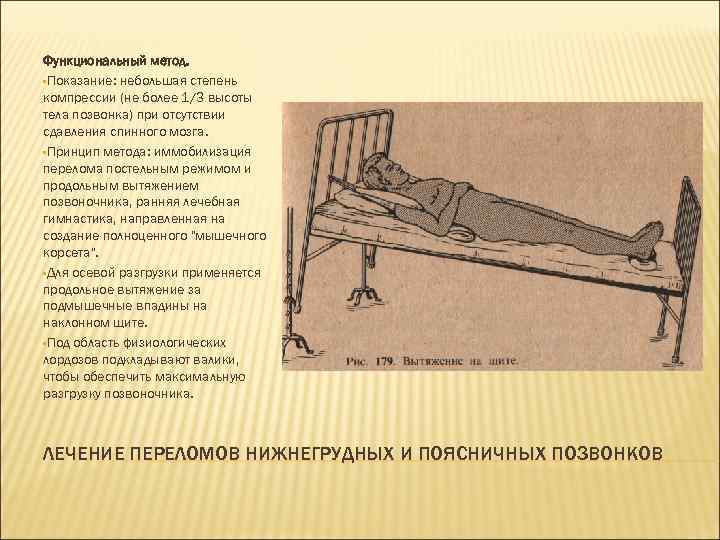 Функциональный метод. • Показание: небольшая степень компрессии (не более 1/3 высоты тела позвонка) при