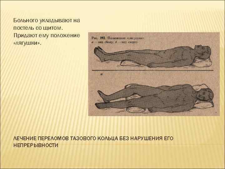 Перелом костей таза карта вызова