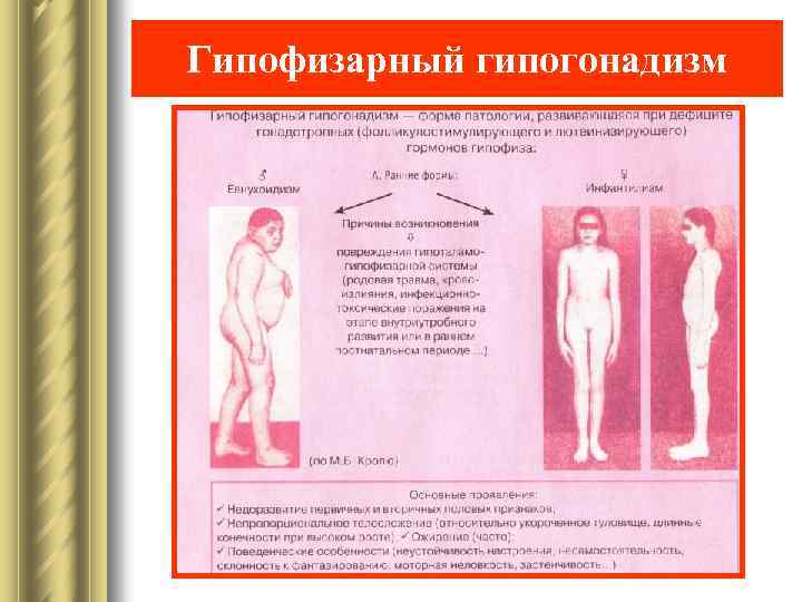 Гипофизарный гипогонадизм 