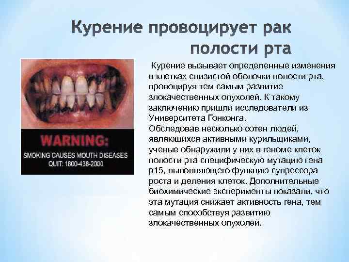 Курение вызывает определенные изменения в клетках слизистой оболочки полости рта, провоцируя тем самым развитие