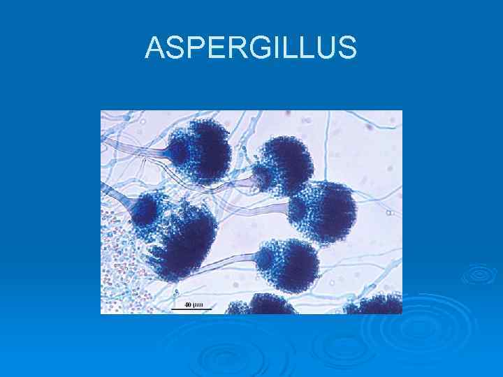 ASPERGILLUS 