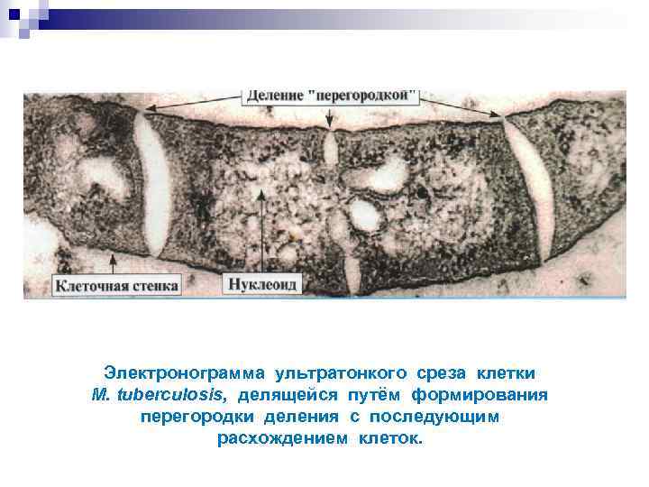 Электронограмма ультратонкого среза клетки M. tuberculosis, делящейся путём формирования перегородки деления c последующим расхождением