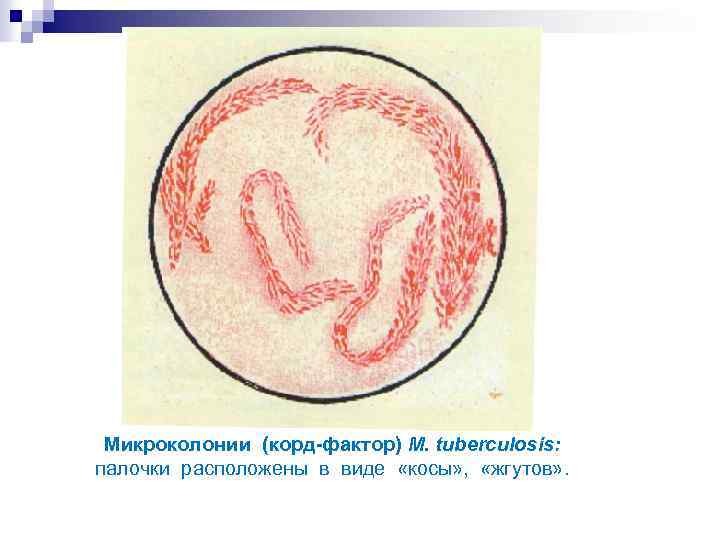 Микроколонии (корд-фактор) M. tuberculosis: палочки расположены в виде «косы» , «жгутов» . 