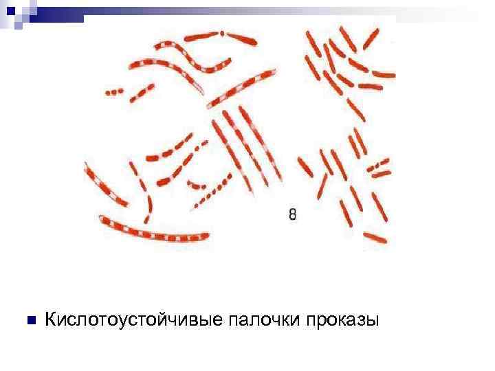 n Кислотоустойчивые палочки проказы 