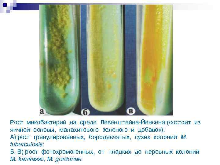 Рост микобактерий на среде Левенштейна-Йенсена (состоит из яичной основы, малахитового зеленого и добавок): А)