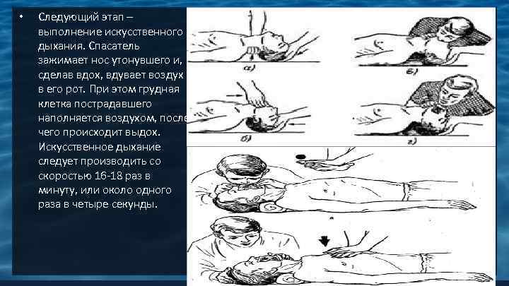  • Следующий этап – выполнение искусственного дыхания. Спасатель зажимает нос утонувшего и, сделав