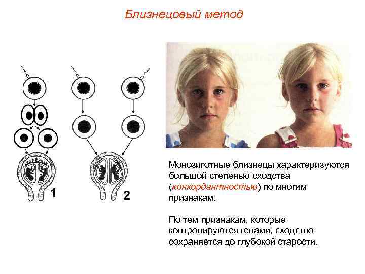 Близнецовый метод Монозиготные близнецы характеризуются большой степенью сходства (конкордантностью) по многим признакам. По тем