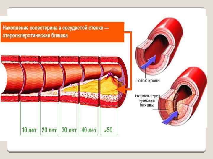Падение сосудистого тонуса. Строение сосудистой стенки. Накопление холестерина в сосудистой стенке. Строение стенки кровеносных сосудов. Изучить строение сосуды,.