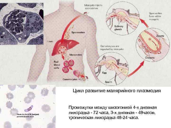  Цикл развитие малярийного плазмодия Промежутки между шизогонией 4 -х дневная лихорадка - 72