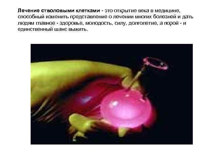 Лечение стволовыми клетками - это открытие века в медицине, способный изменить представление о лечении
