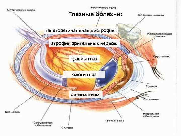  Глазные болезни: тапеторетинальная дистрофия атрофия зрительных нервов травмы глаз ожоги глаз астигматизм 