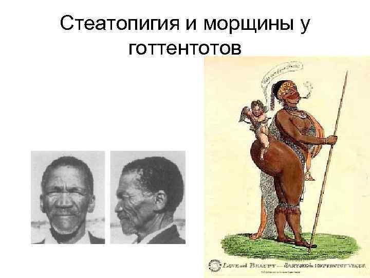 Стеатопигия и морщины у готтентотов 