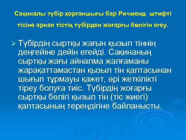 Сақиналы түбір қорғаншығы бар Ричмонд штифті тісіне арнап тістің түбірден жоғарғы бөлігін егеу. Ø