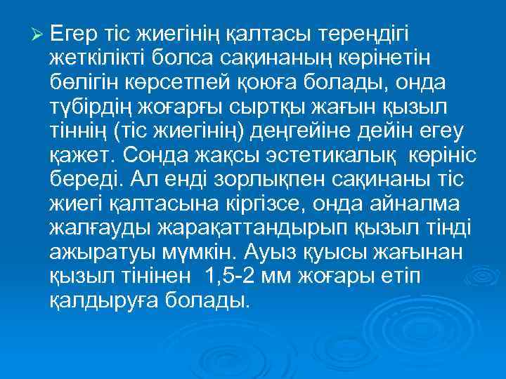 Ø Егер тіс жиегінің қалтасы тереңдігі жеткілікті болса сақинаның көрінетін бөлігін көрсетпей қоюға болады,