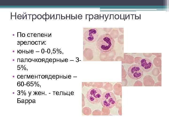 Нейтрофильные гранулоциты • По степени зрелости: • юные – 0 -0, 5%, • палочкоядерные