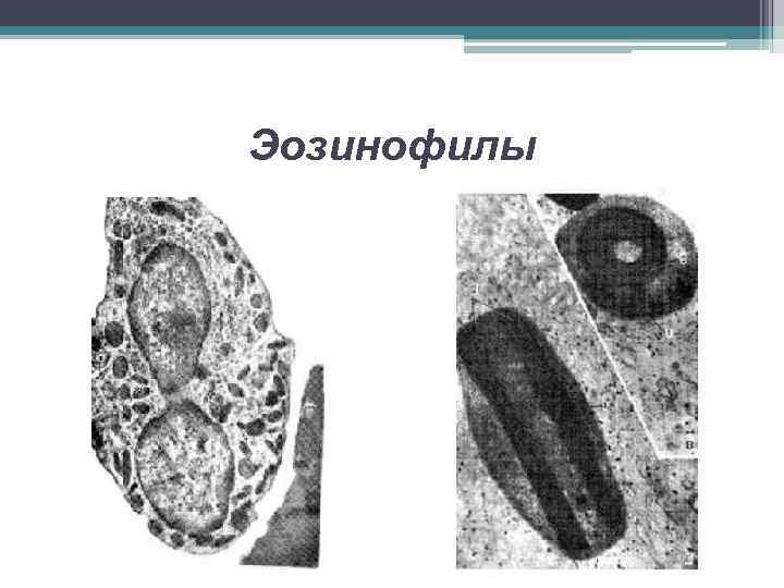 Эозинофилы 